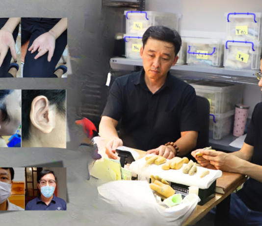 Đôi Bạn Hà Thành ‘Biến Silicon thành Da Thịt’ – Sự Bứt Phá Kỳ Diệu Dành Cho Người Khuyếm Khuyết