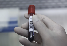 8 Lầm Tưởng Thường Gặp Về Cholesterol Qua Góc Nhìn Của Bác Sĩ Tim Mạch