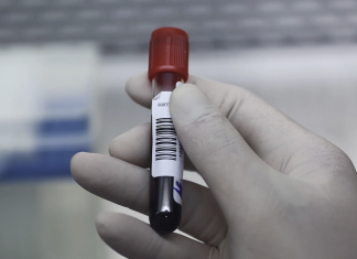 8 Lầm Tưởng Thường Gặp Về Cholesterol Qua Góc Nhìn Của Bác Sĩ Tim Mạch