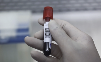 8 Lầm Tưởng Thường Gặp Về Cholesterol Qua Góc Nhìn Của Bác Sĩ Tim Mạch