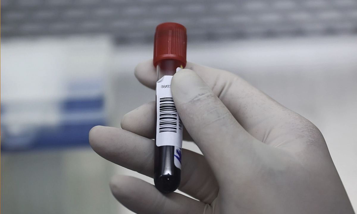 Cholesterol thường bị hiểu sai và gây nhiều nhầm lẫn trong cách chăm sóc sức khỏe tim mạch.